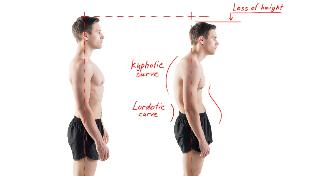 Posture Power - Perfecto Physios - Rebuild Yourself