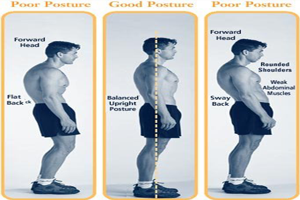 Poor Posture - Perfecto Physios - Rebuild Yourself