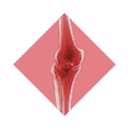 xray-overlay-knee overlay knee